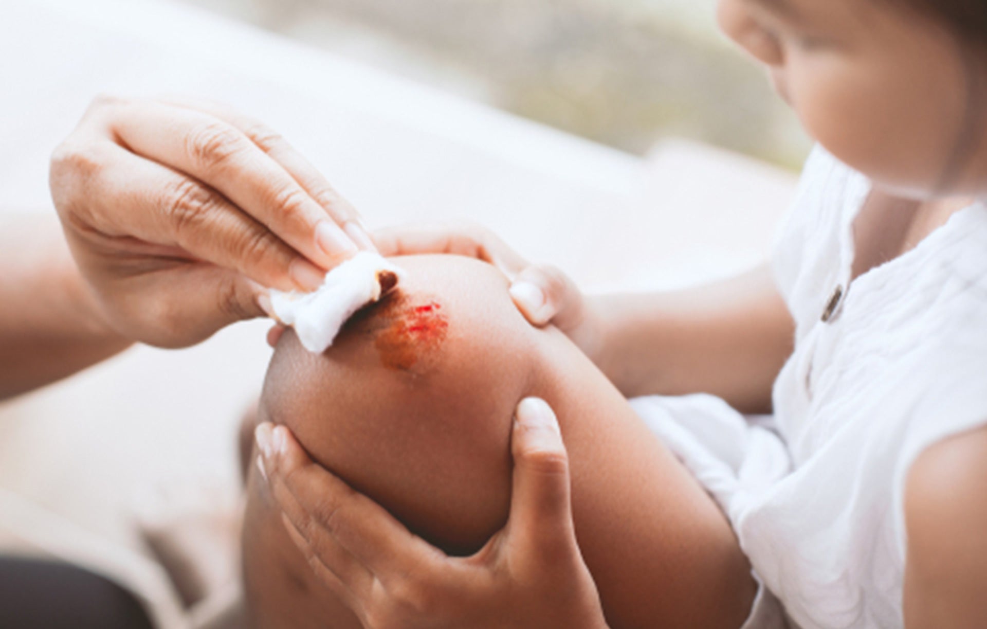 How Often Do Medical Adhesive-Related Skin Injuries Occur